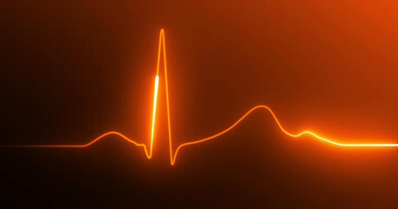 Visual Representation of a pulse on a heart rate monitor